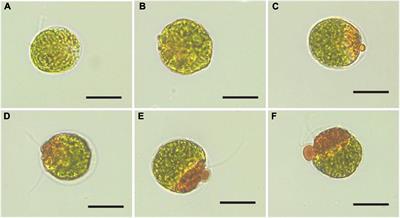 Haematococcus pluvialis Accumulated Lipid and Astaxanthin in a Moderate and Sustainable Way by the Self-Protection Mechanism of Salicylic Acid Under Sodium Acetate Stress